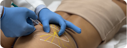 Tratamentos Corporales en Madrid