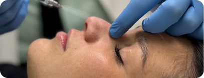 Tratamentos Faciales en Madrid